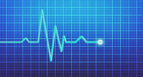 Abnormalities of Heart Rhythm